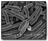 Escherichia_Coli